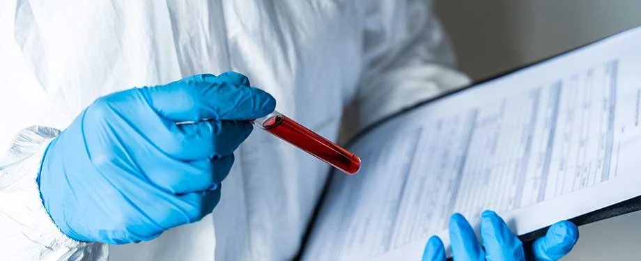 O que &eacute; preciso para realizar exame toxicol&oacute;gico? Na imagem, profissional segura amostra de sangue para realiza&ccedil;&atilde;o de exame toxicol&oacute;gico 